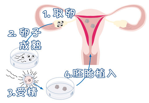 专业拉拉代怀助孕费用多少